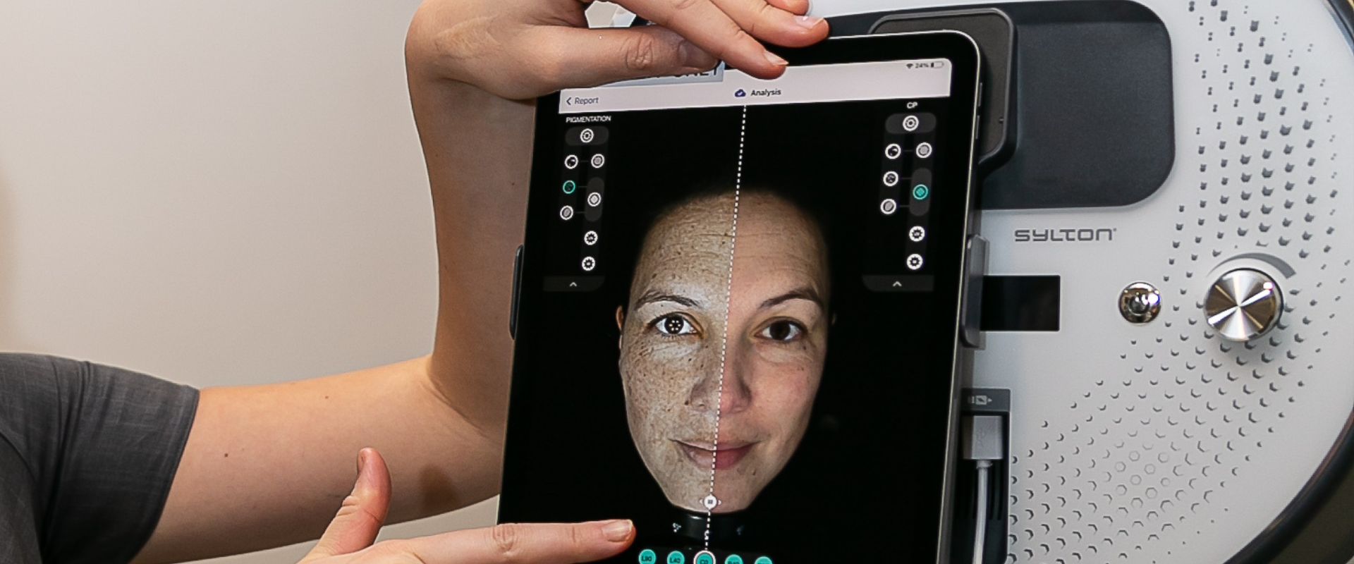 Skin analysis in Colchester using advanced skin scanning technology